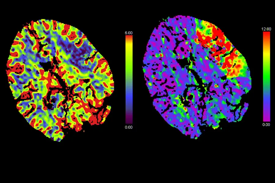 Radiologiebild einer Patientin in der Klinik Landstrasse
