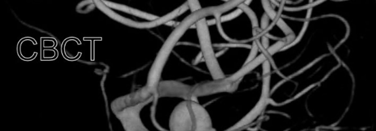 3D Angiographie Bild